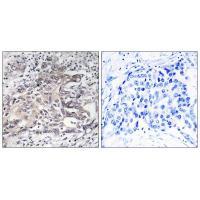 Cytochrome P450 4X1 Antibody 
