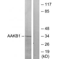 PRKAB1 Antibody