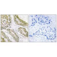 BAX Antibody