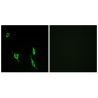 DCC Antibody