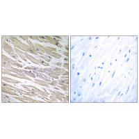 LAMA4 Antibody