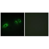 LAMB1 Antibody