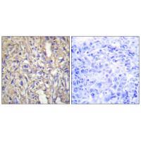 LAMB1 Antibody