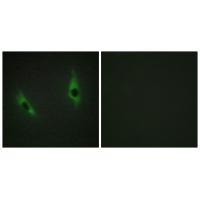 LAMB3 Antibody 