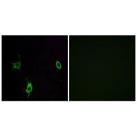 LAMC3 Antibody