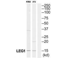 LGALS1 Antibody
