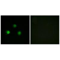 MSH2 Antibody 