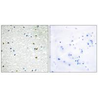 PARP3 Antibody
