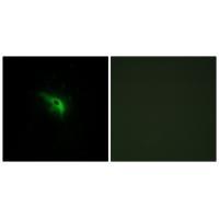 TPIP1 Antibody 