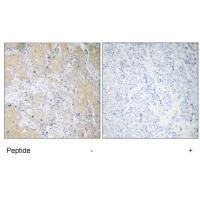 PSMD3 Antibody