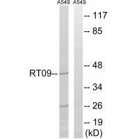 MRPS9 Antibody 