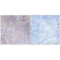 MRPL11 Antibody