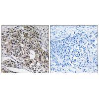 MRPL13 Antibody