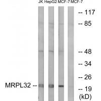 MRPL32 Antibody