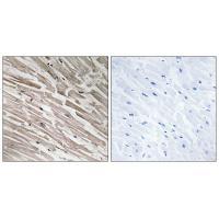 MRPL44 Antibody