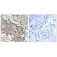 HIBADH Antibody