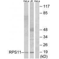 RPS11 Antibody