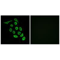 RPS12 Antibody 