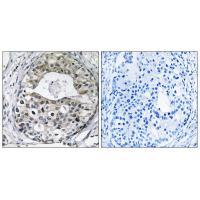 RPS13 Antibody
