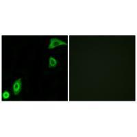 RPS20 Antibody