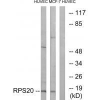 RPS20 Antibody