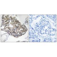 RPS25 Antibody 