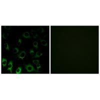 RPS4X Antibody 