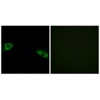 RPS4Y1 Antibody 