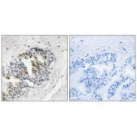 RPLP2 Antibody