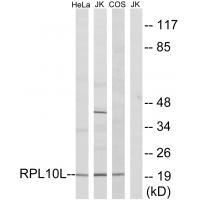 RPL10L Antibody