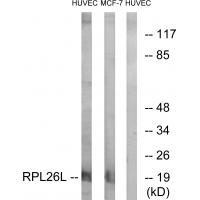 RPL26L Antibody