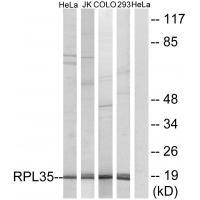 RPL35 Antibody