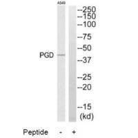 PGD Antibody