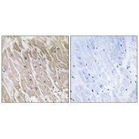 ACAD10 Antibody