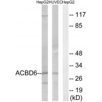 ACBD6 Antibody