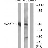 ACOT4 Antibody