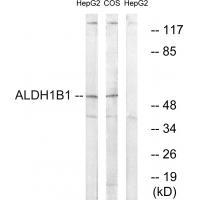 ALDH1B1 Antibody