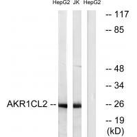 AKR1CL2 Antibody 