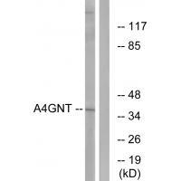 A4GNT Antibody
