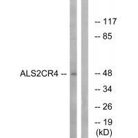 ALS2CR4 Antibody
