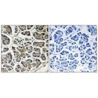 ATP5G2 Antibody