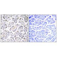 ATP5G3 Antibody