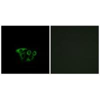 ATP5L2 Antibody