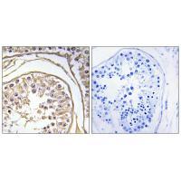 BAGE2 Antibody