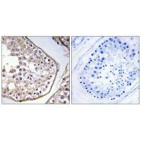 BAGE3 Antibody