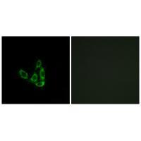 GCNT3 Antibody