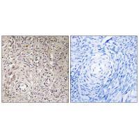 GCNT7 Antibody