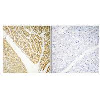 CABP7 Antibody 