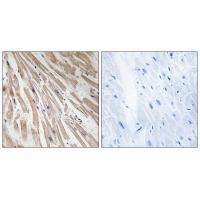 ARPP21 Antibody