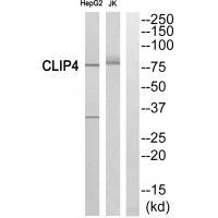 CLIP4 Antibody